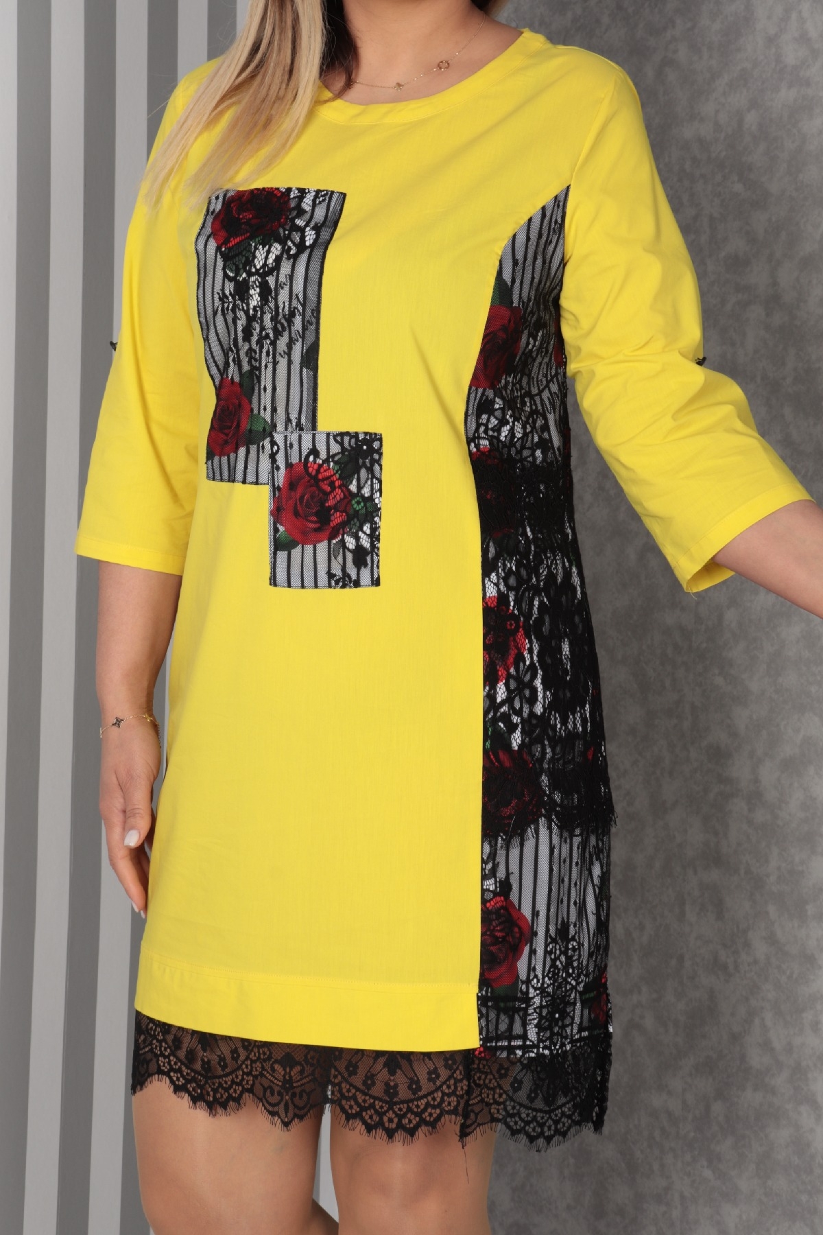 Casual Dresses-Yellow